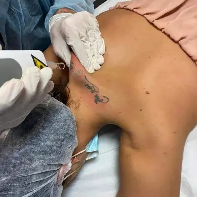 First Photo Before And After