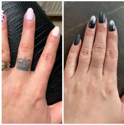 Last Photo Before And After